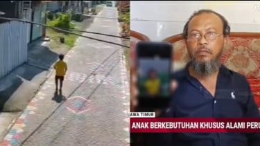 Anak Down Syndrome di Surabaya Meninggal Diduga Dibully Dua Bocah Tetangganya