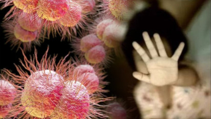 Bocah 3,5 Tahun Menderita Gonore, Setelah Dicabuli Ayah Kandung yang Berprofesi sebagai Dokter