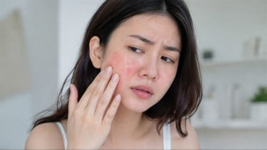 Kulit Sedang Iritasi, Hindari 3 Kesalahan Ini agar Tidak Makin Parah